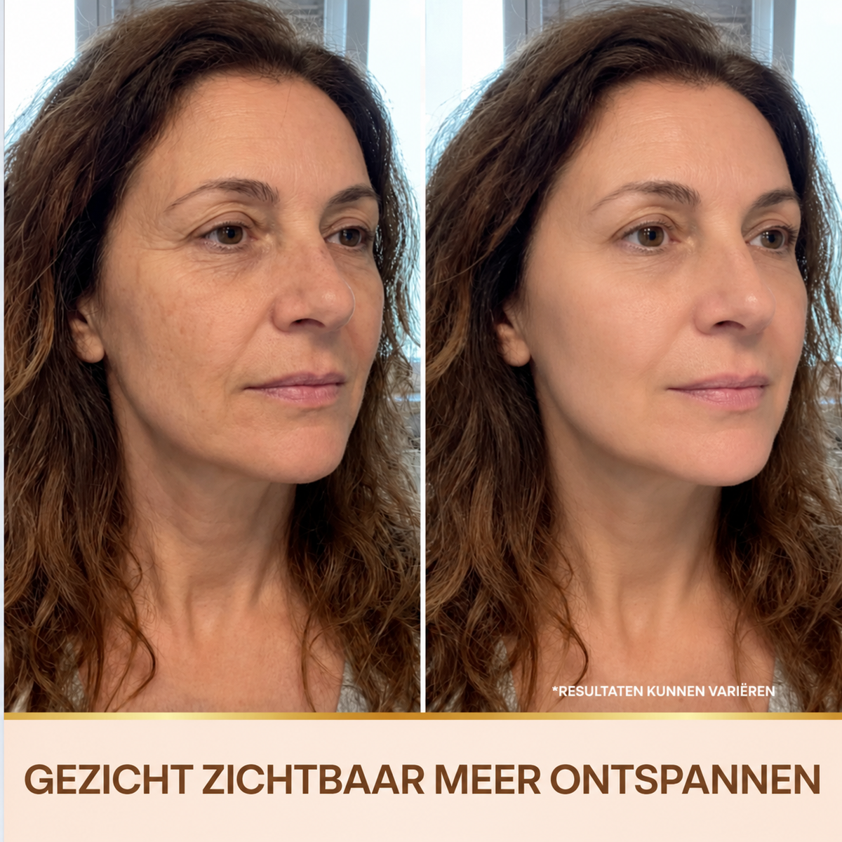 Ellegante | Golden Lift Serum